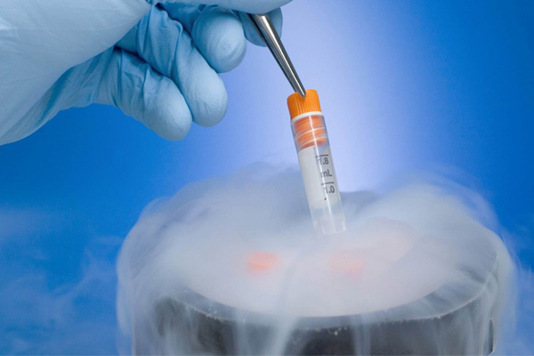 泰国试管婴儿的3种冻胚移植方案
